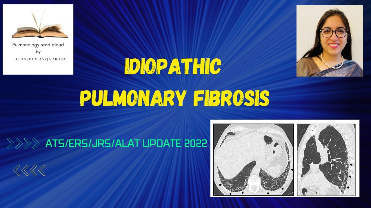 Idiopathic Pulmonary Fibrosis- ATS/ERS/JRS/ALAT update 2022