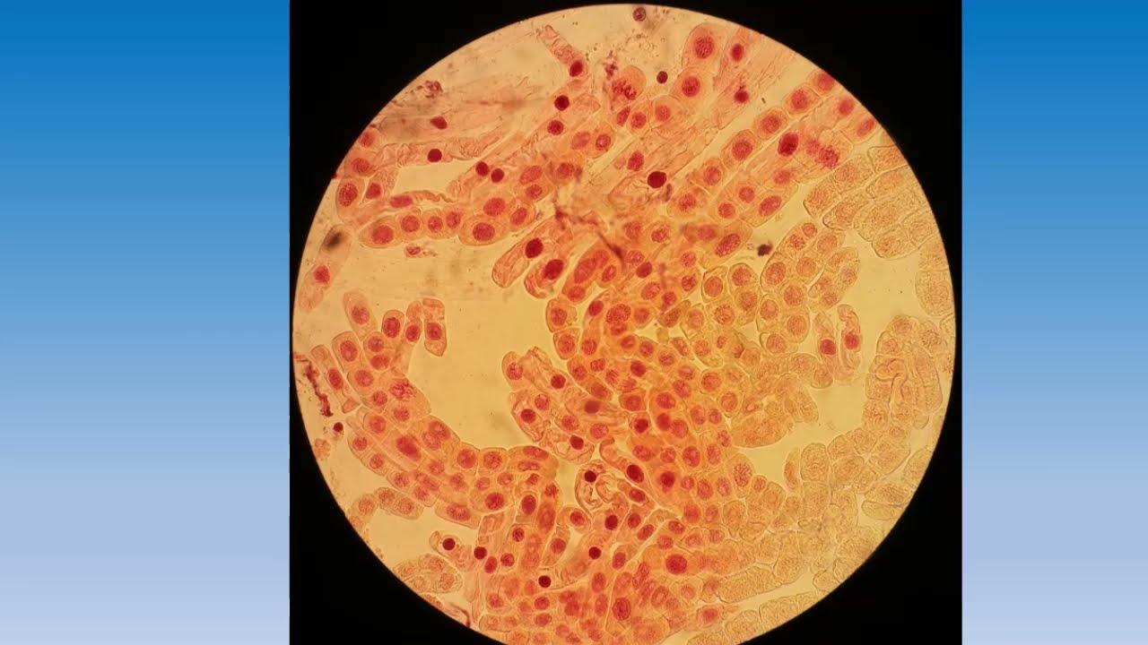 Mitosis de raíz de cebolla