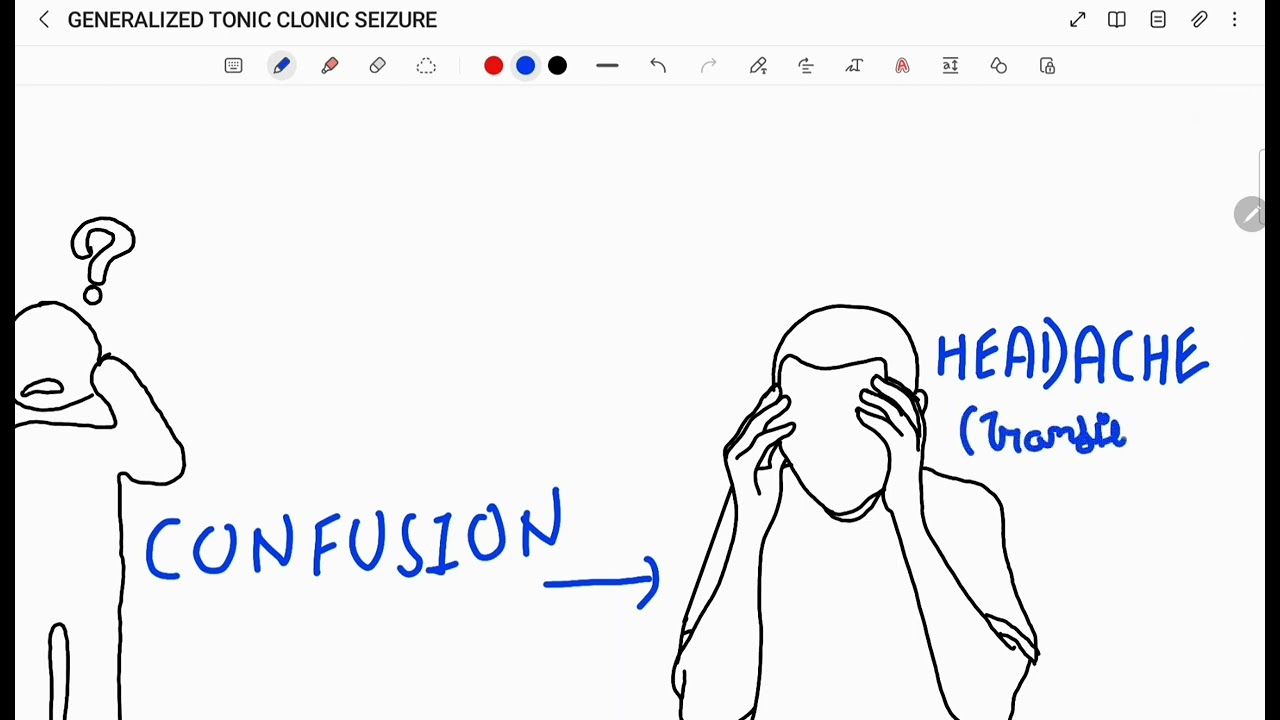GENERALISED TONIC CLONIC SEIZURES | GTCS | GRAND MAL EPILEPSY