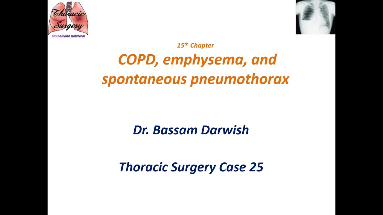 COPD, emphysema, and spontaneous pneumothoraxالريح الصدرية و ال COPD و النفاخ الرئوي