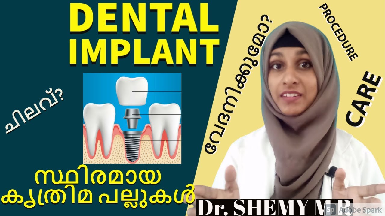 Is DENTAL IMPLANT painful? (2021) ||കൃത്രിമ ദന്തങ്ങള്‍ വേദനിക്കുമോ?|| Dr SHEMY M R