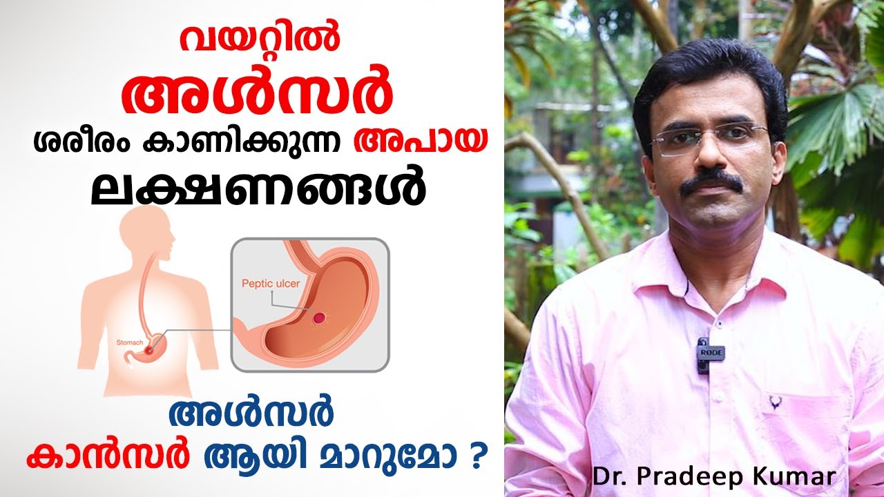 വയറിലെ അൾസർ കാൻസർ ആയി മാറുമോ ? ഈ അപായ ലക്ഷണങ്ങൾ സൂക്ഷിക്കുക | Ulcer Malayalam