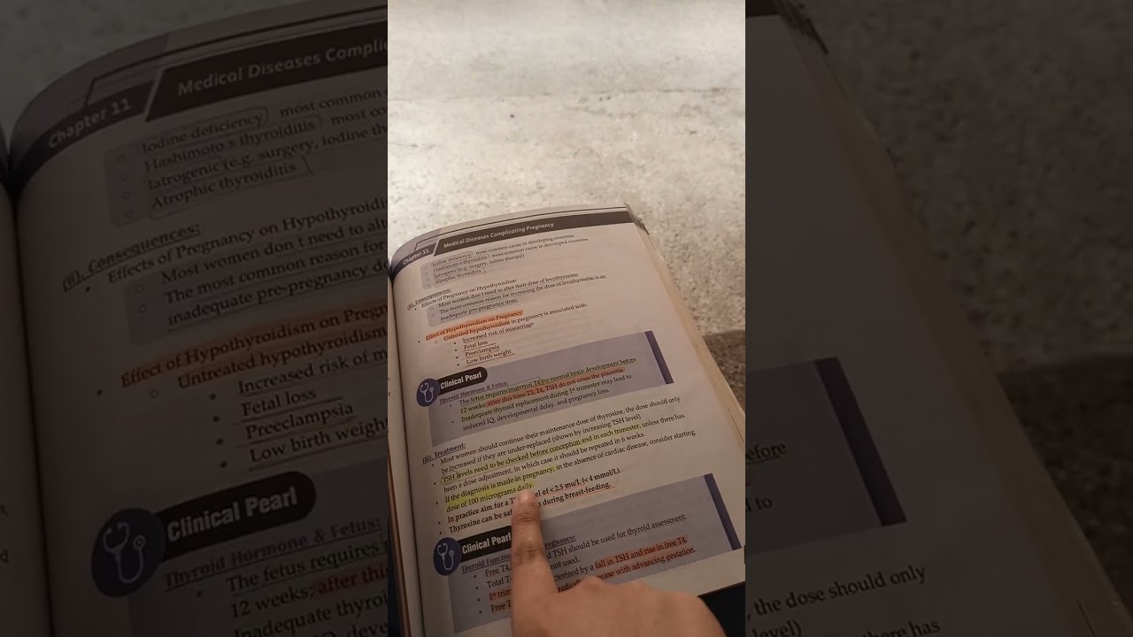 Ch 11pt.2 Medical diseases complicating pregnancy,obstetrics, Irfan Masood quick review