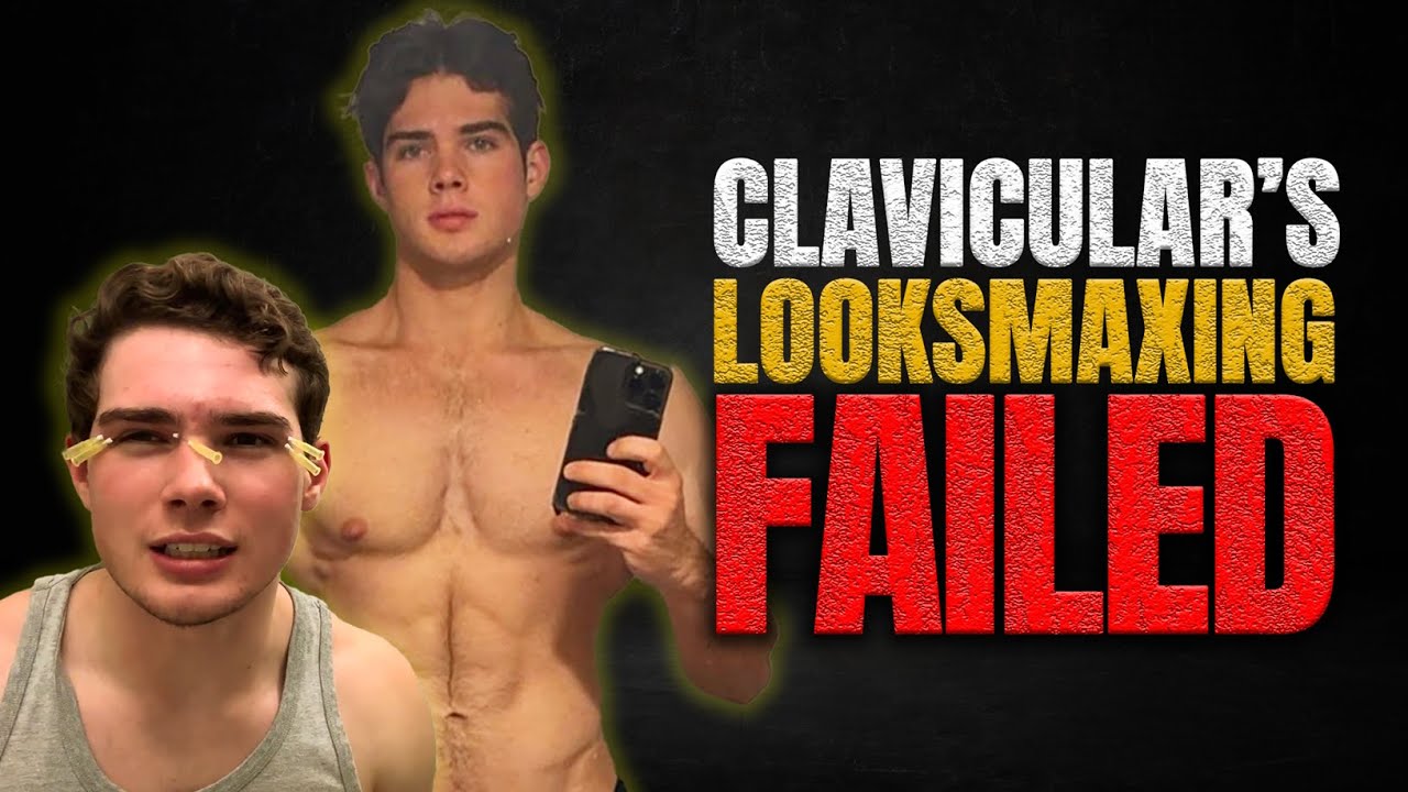 Clavicular&rsquo;s lookmaxxing journey just got even worse