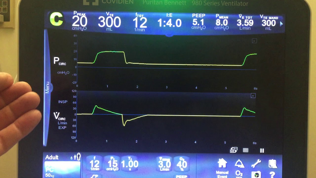 Pressure Control Ventilation [PCV] - Basics Part 1