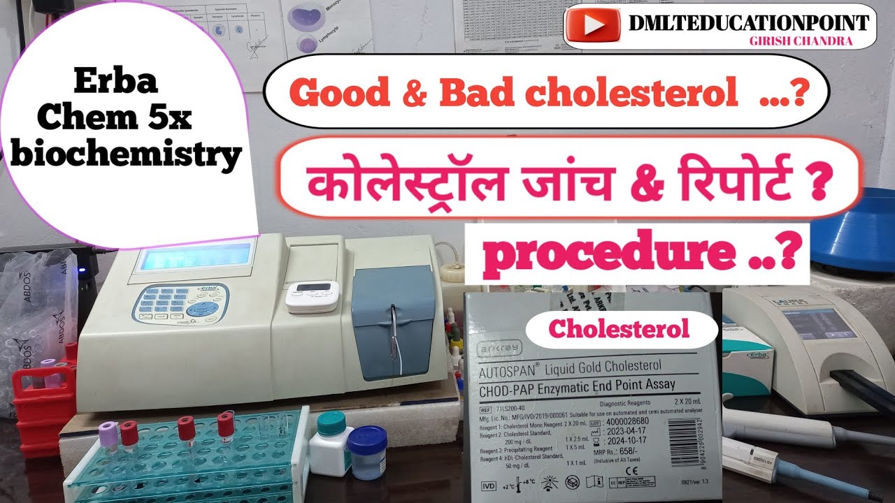 Serum cholesterol test | cholesterol test in hindi | Lipid Profile test CHOD/PODmethod #cholesterol