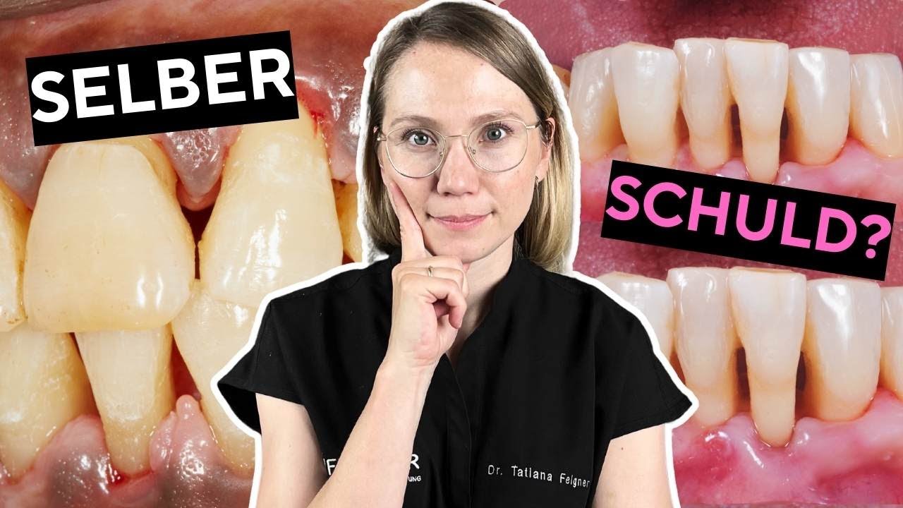 Freiliegende Zahnhälse? Das sind die wahren Gründe!