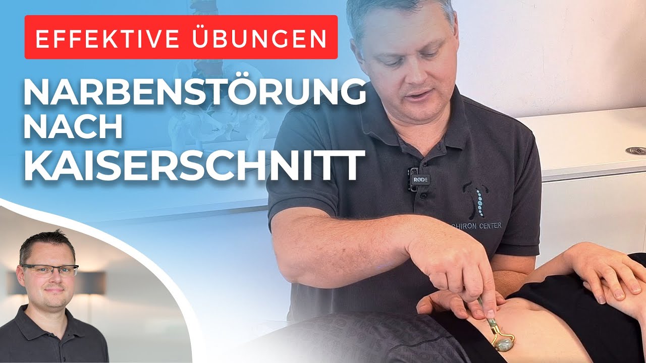 Narbe nach Kaiserschnitt pflegen - Wie Du richtig massierst!