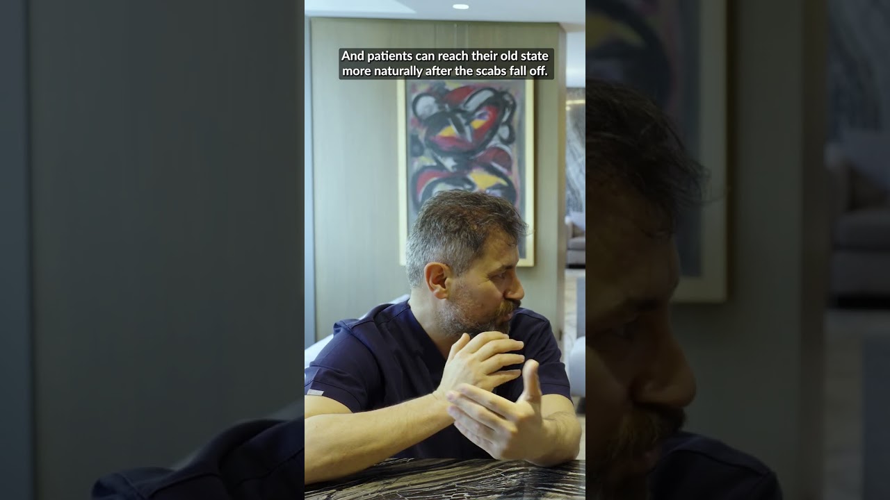 WHEN CAN I GO BACK TO MY NORMAL LIFE AFTER HAIR TRANSPLANT?