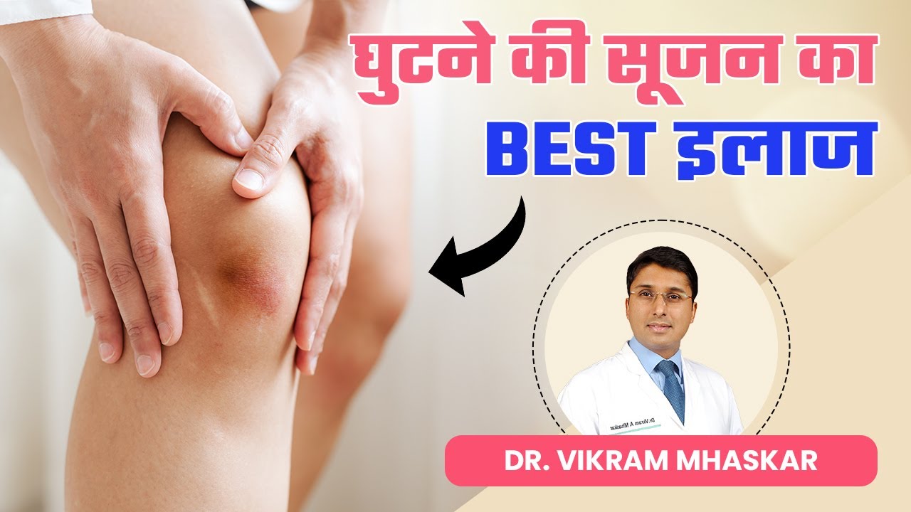 घुटने में सूजन क्या होता है?  घुटने की सूजन का Best इलाज | Best Doctors for Knee Effusion in Delhi