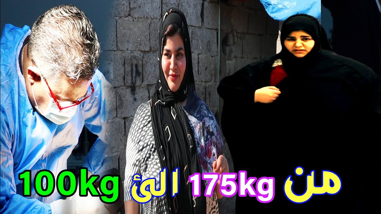 بعدما عانت الامرين الزبيدي رجعها للحياة رادت عملية تجميلية والرد كان !؟
