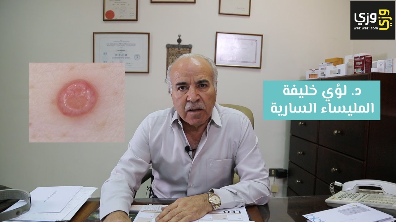 مرض المليساء المعدية ( السارية )