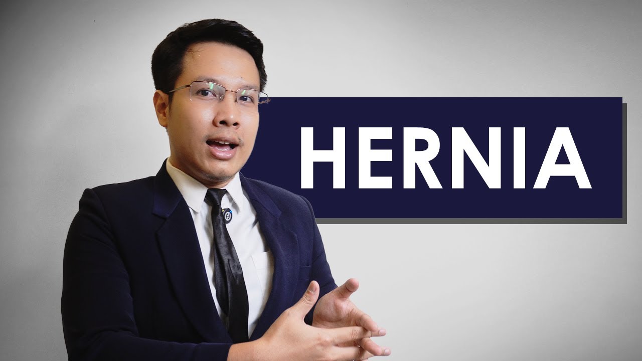 Penyebab Tersering Benjolan di Perut: Hernia