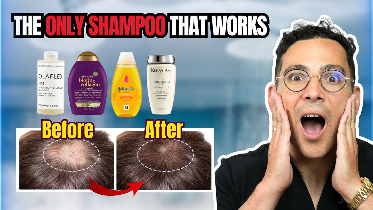 What is the Best Shampoo for Hair Loss? Doctor Reveals the Truth