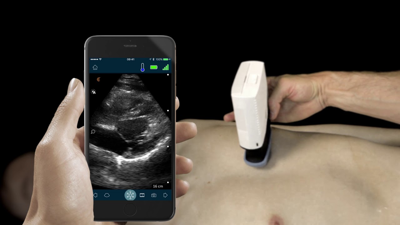 How to use Clarius for a FAST Exam | Clarius Portable Handheld Ultrasound