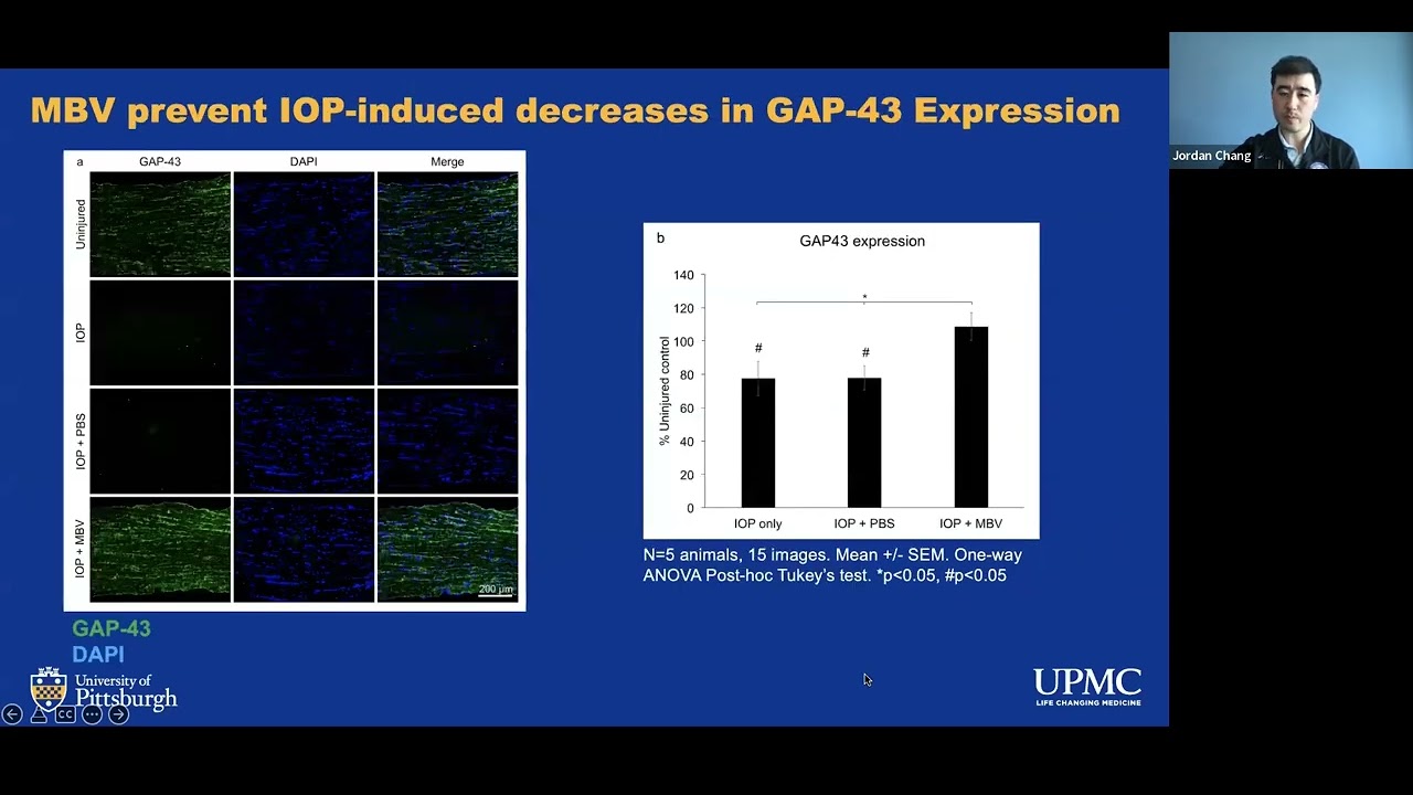 Sight + Sound Bites: Growing Optic Nerve - Progress on Optic Nerve Regeneration