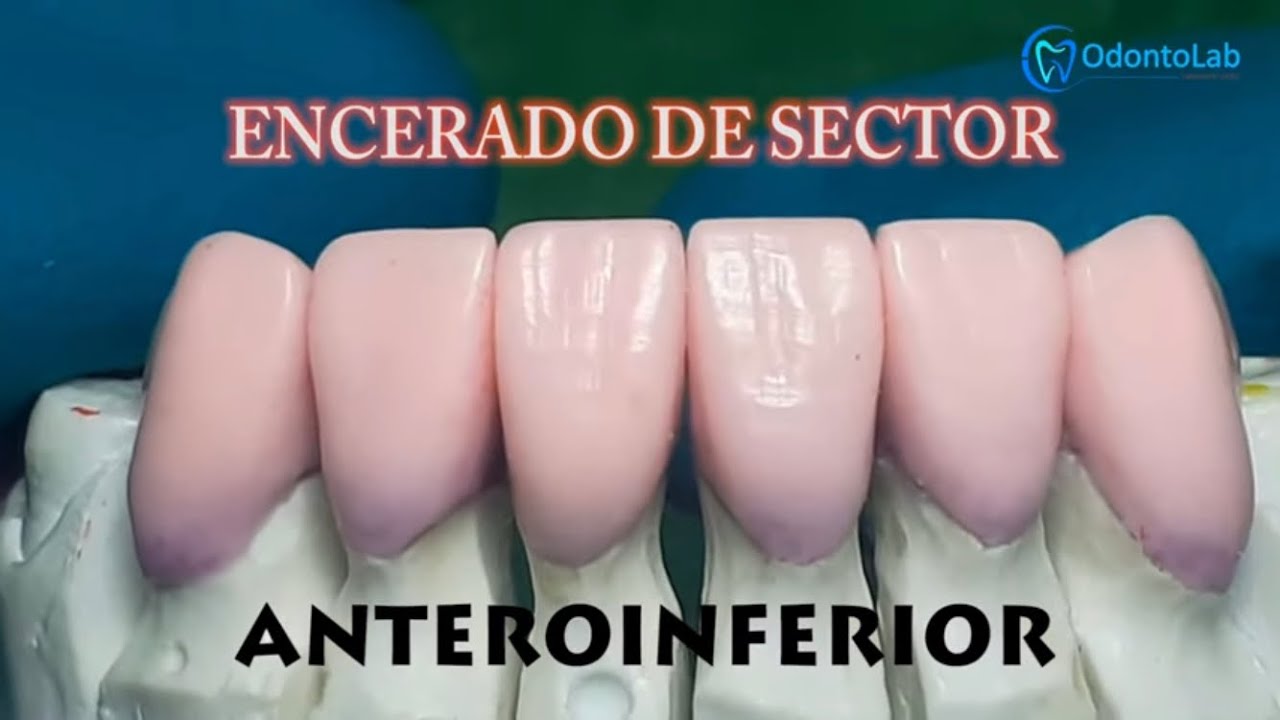 ENCERADO ANTEROINFERIOR ;) ;) ;)