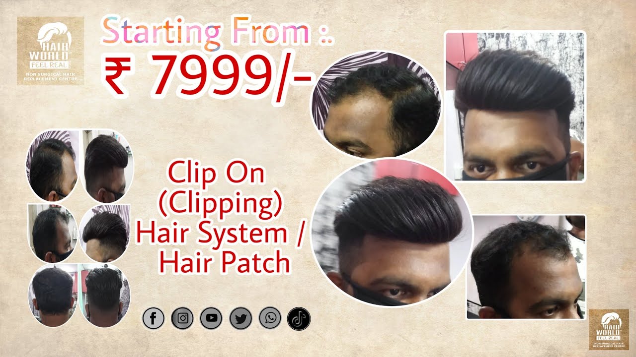 Hair Fixing For Men | Hair Wigs For Men | Hair Patch | Hair System | Hair Replacement | By HAIRWORLD