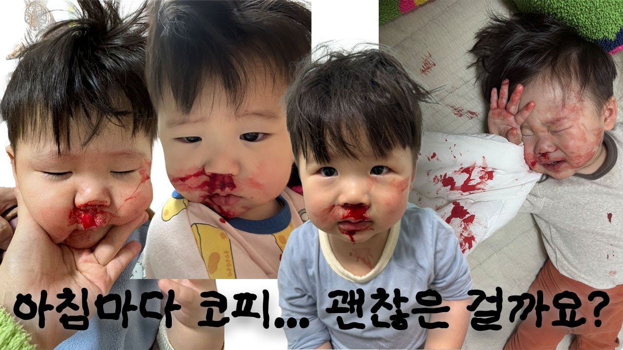 워킹맘 Vlog 🩸 |  매일 아침 코피나는 아들, 네블라이저를 써봤어요, 뽀로로테마파크 일산점, 잠실 아쿠아리움, 성심당 케익, 햄버거 매니아 엄마