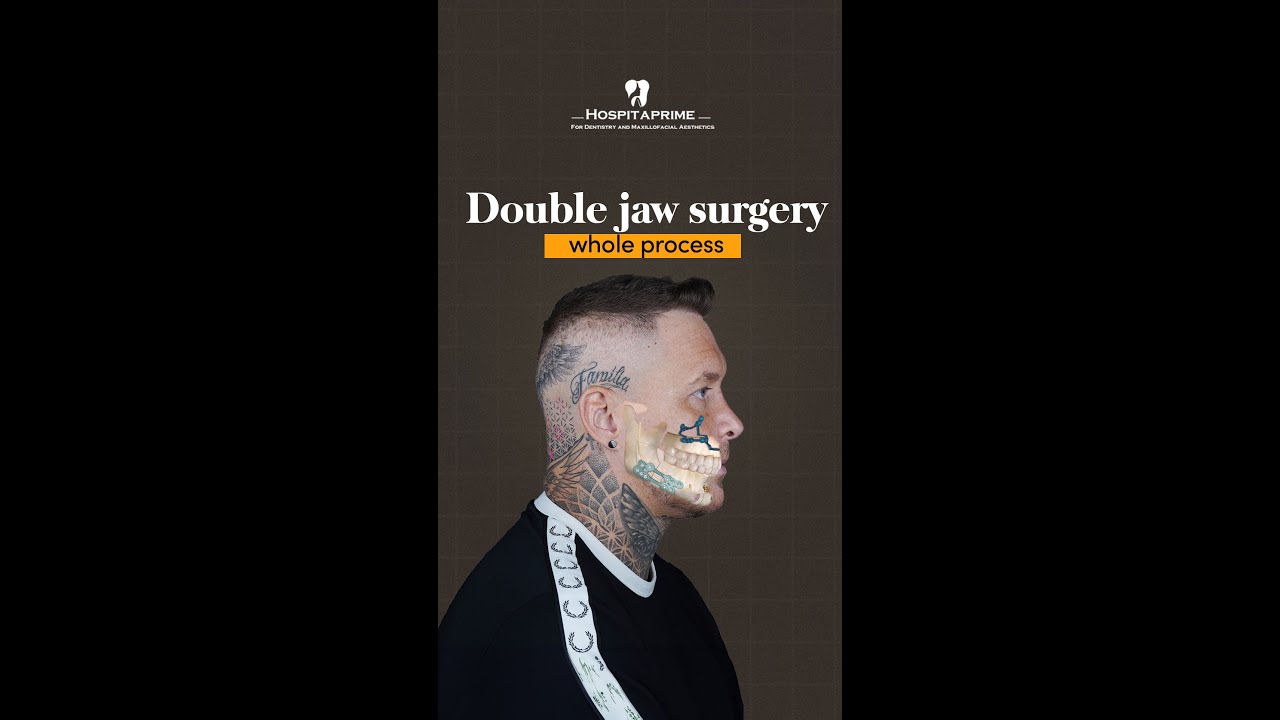 Double jaw surgery whole process - Dr. Eren Pera - Hospitaprime #shorts