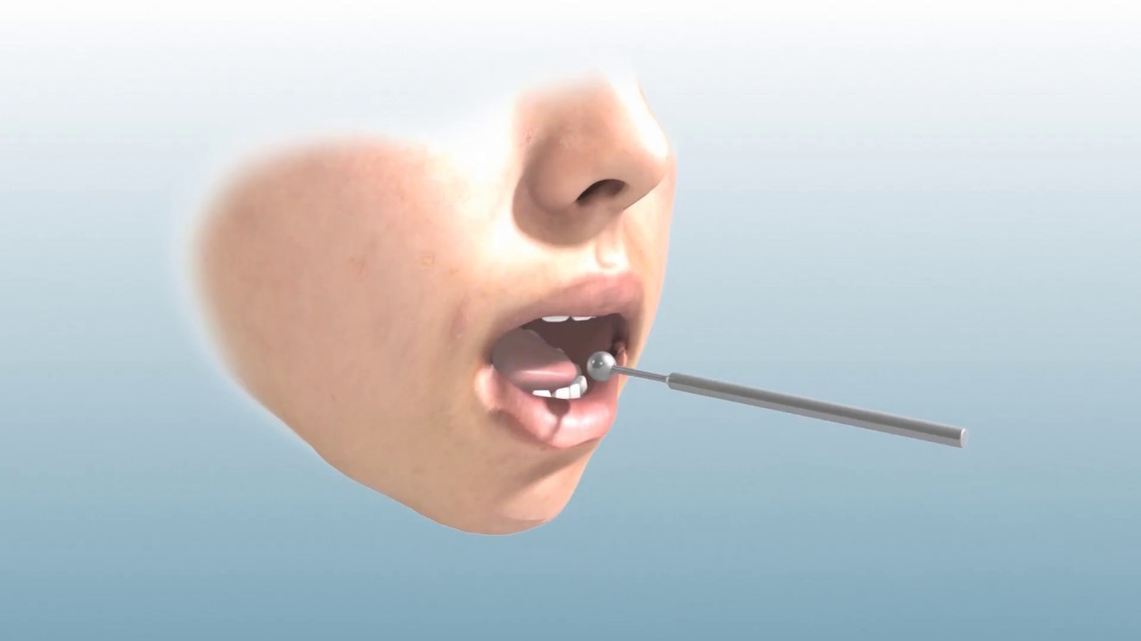 Speech Sondes (long version animated)