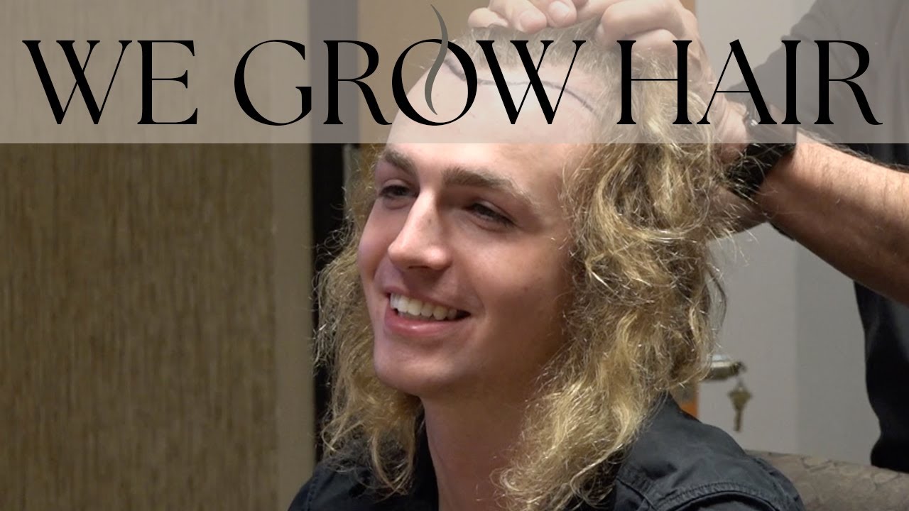 Can a Hair Transplant Make Your Hair Thicker?