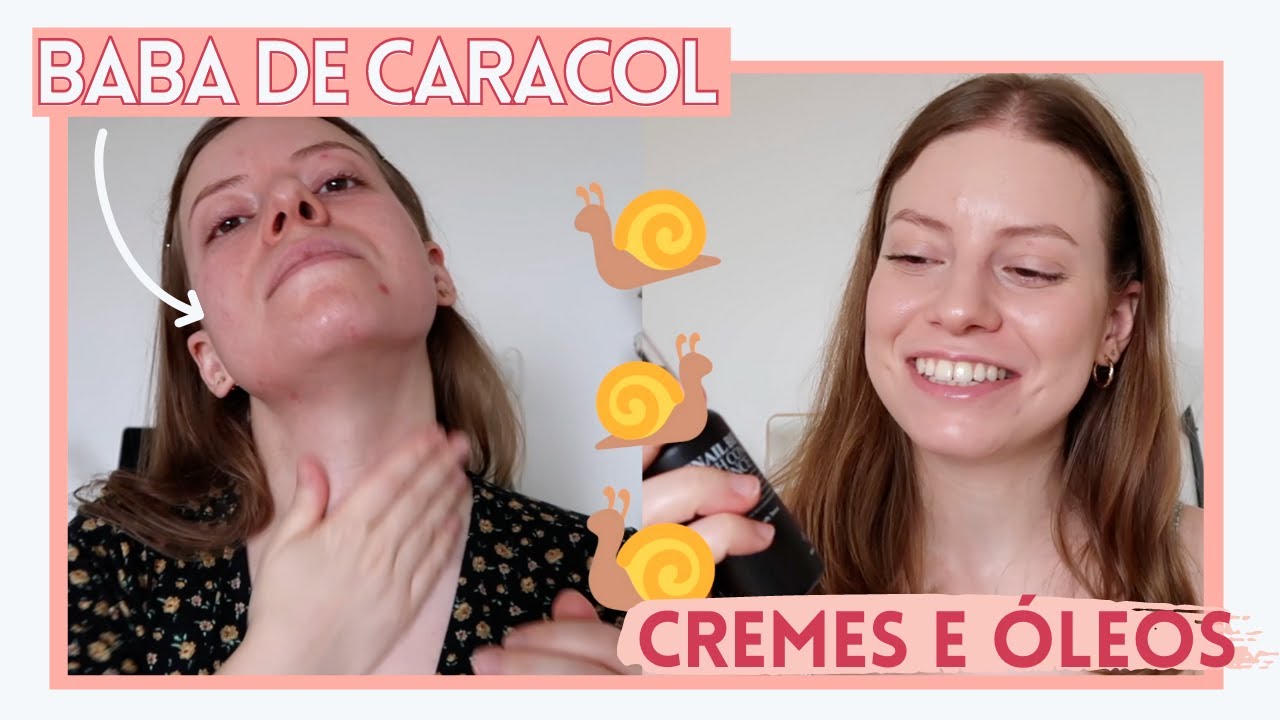 Pele Oleosa Pode Usar HIDRATANTE? | Meu TOP 5 para pele oleosa e acneica | Aplicação e sensorial 💦