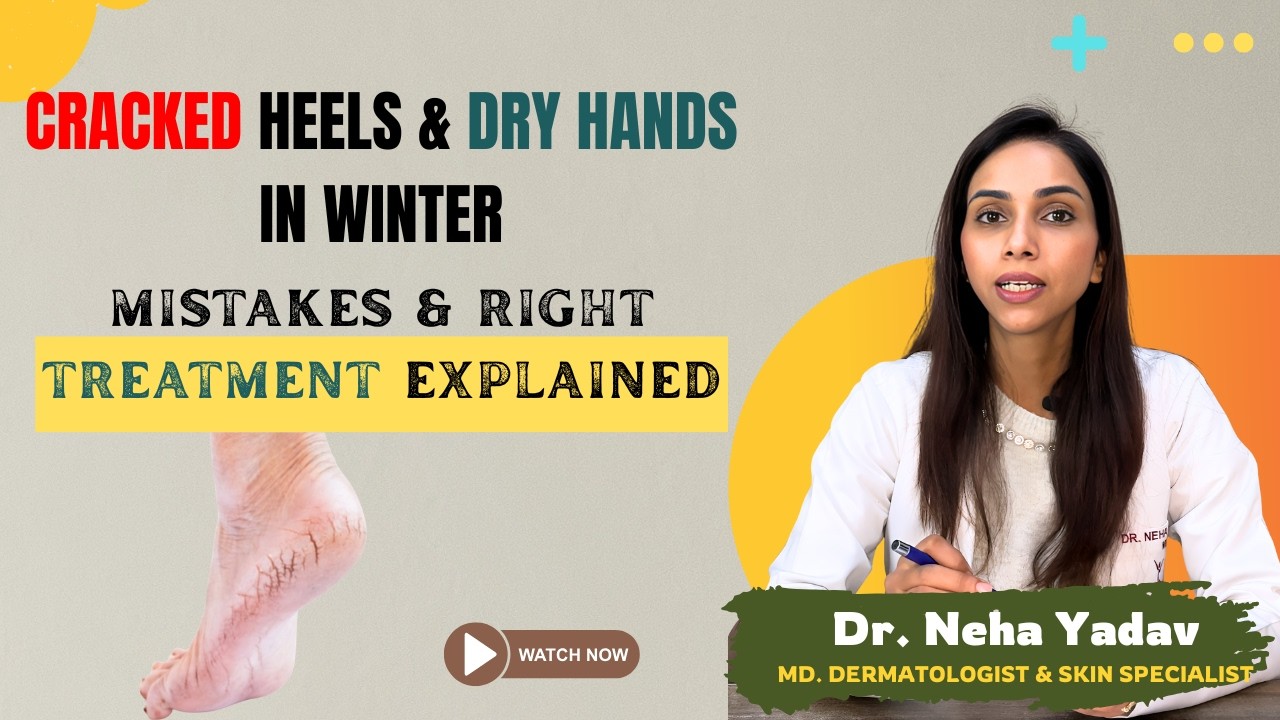 Cracked Heels & Dry Hands in Winter? Mistakes & Right Treatment Explained - Dr Neha Yadav