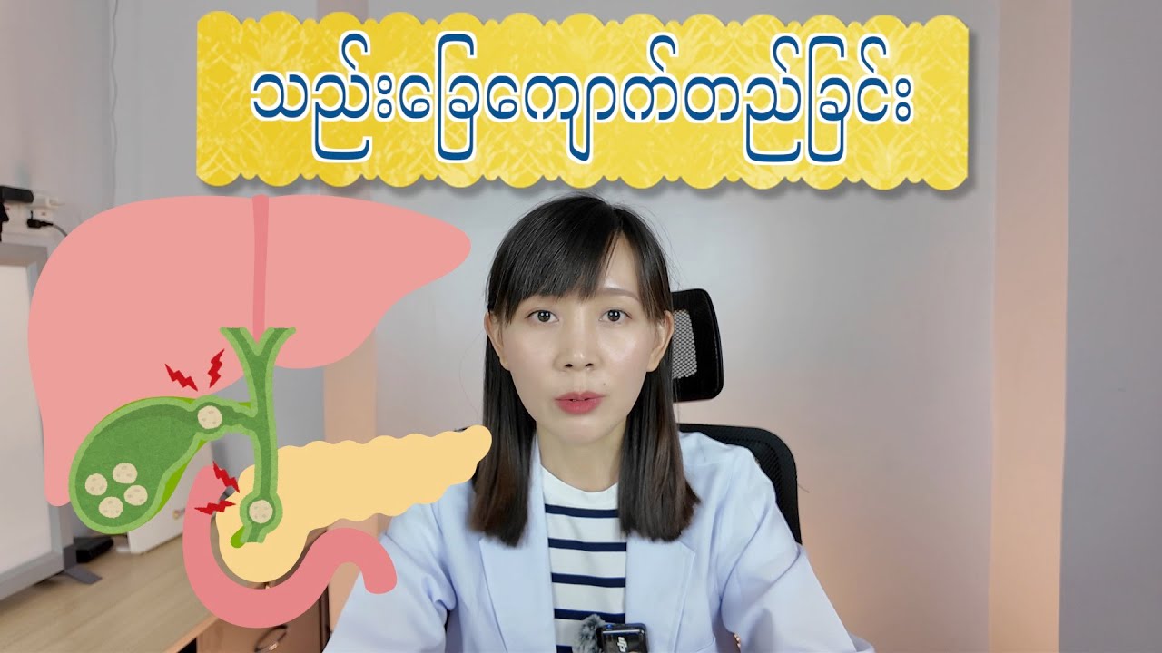 သည်းခြေကျောက်တည်ခြင်းအကြောင်းသိကောင်းစရာများ | Gall stones | 4K