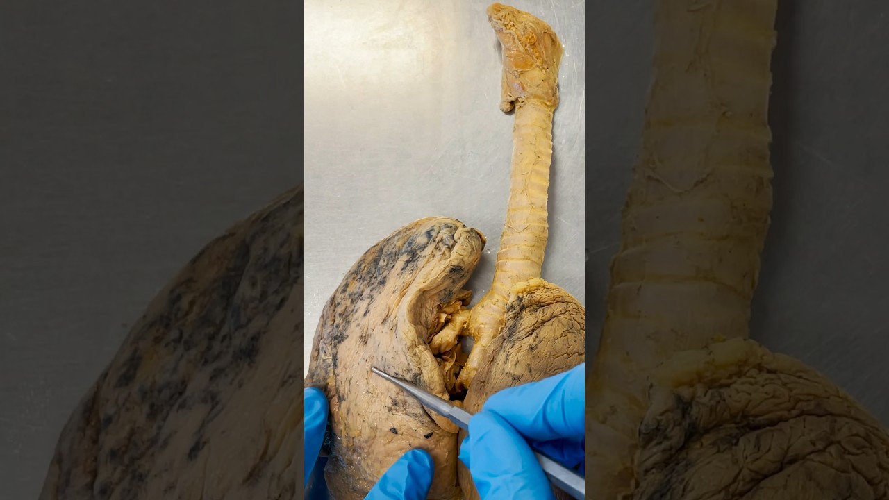 Lungs the Size of a Tennis Court!? #breathing #lungs