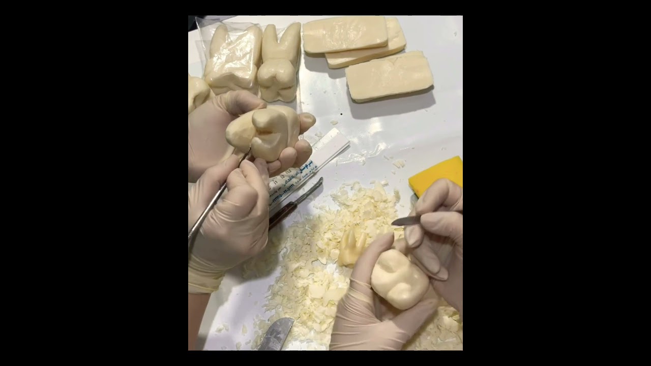 Soap carving-Maxillary first molar🦷