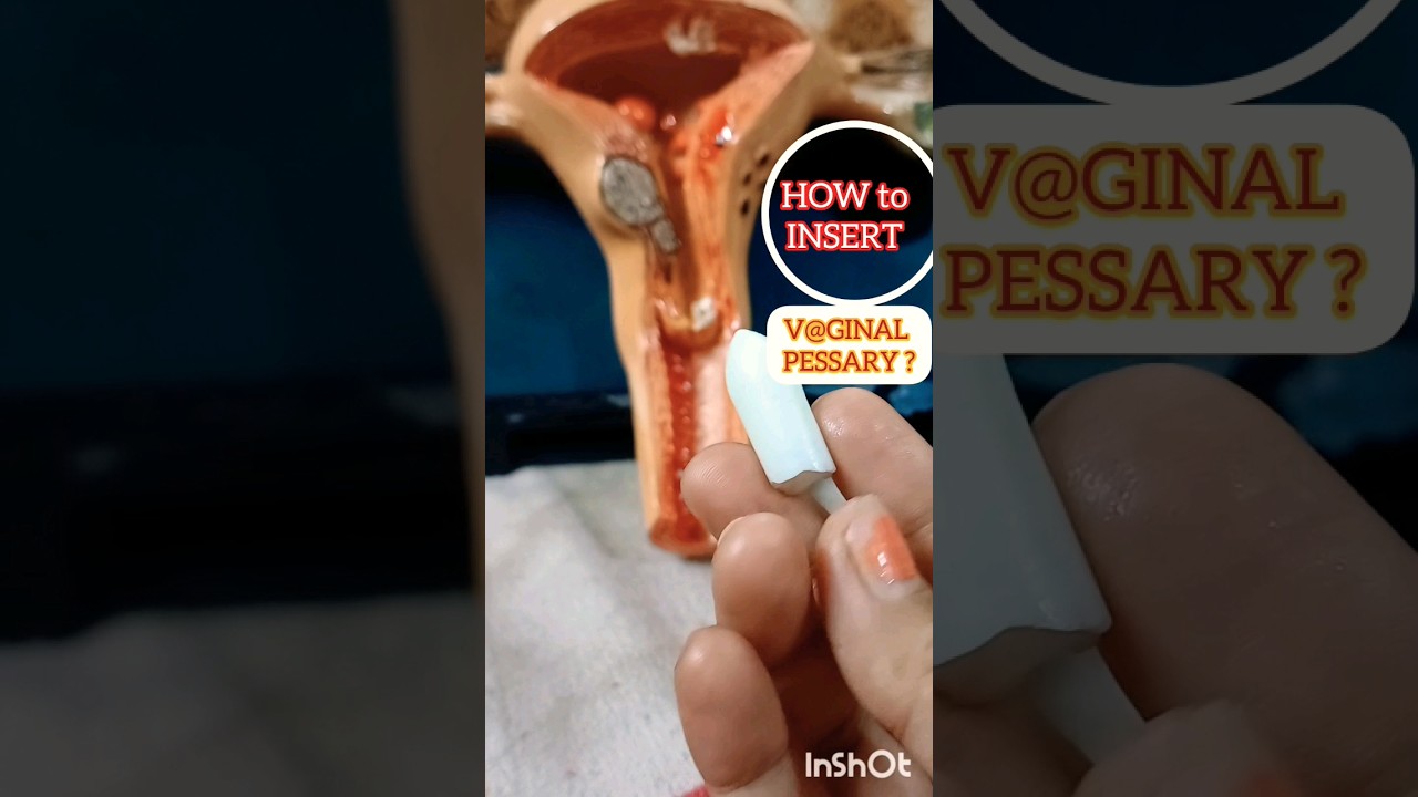 How to apply VAGINAL PESSARY at home? DR BIMALA #vaginalhealth #vaginacare #vaginalpessary #vagina