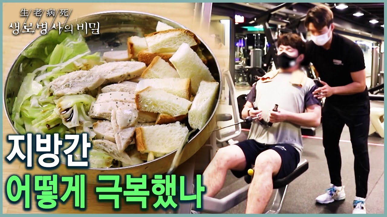 지방간 없애는 식단, 운동 생활습관 (KBS 20211110 방송)