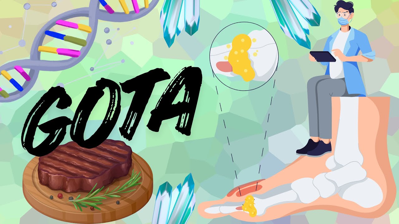 GOTA