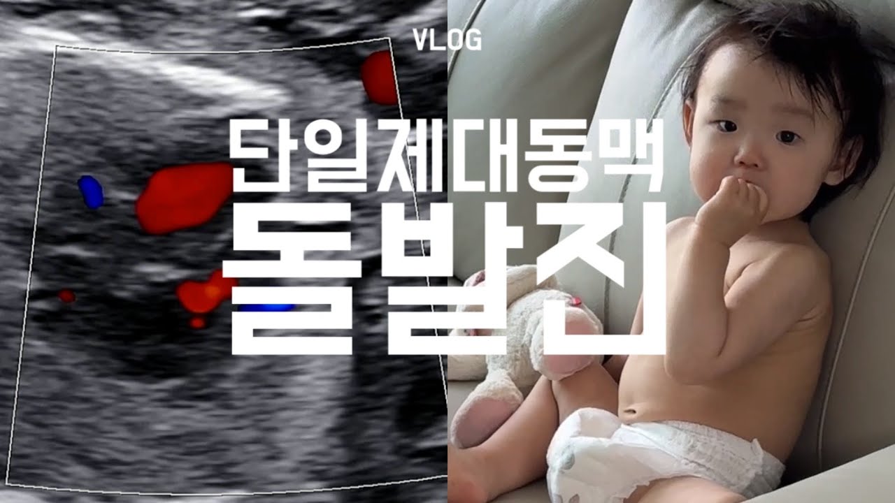 둘째가 단일제대동맥 진단을 받았습니다… 🥹  14개월 아기 발달 | 돌발진, 돌치레, 열꽃 | 고양 아쿠아플라넷 | 단동맥