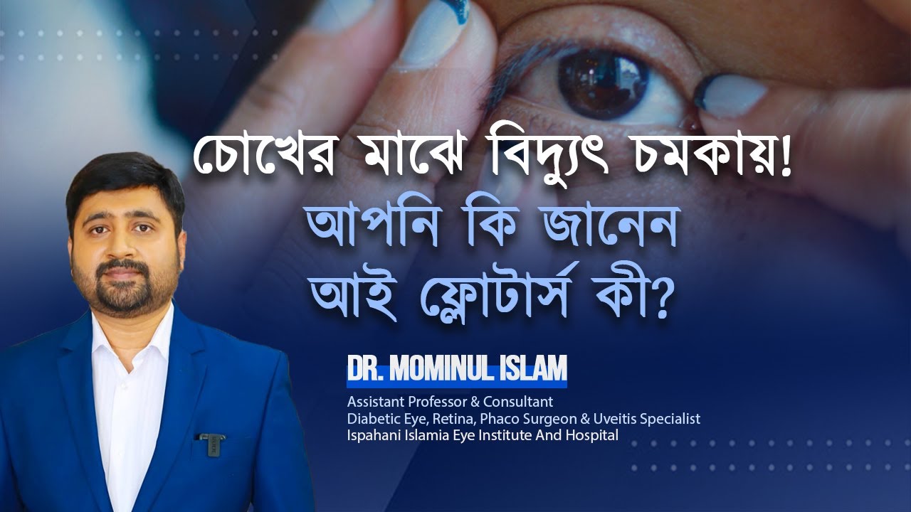 চোখের সামনে মাছির মতো নড়ে। Eye floaters! Dr Mominul islam