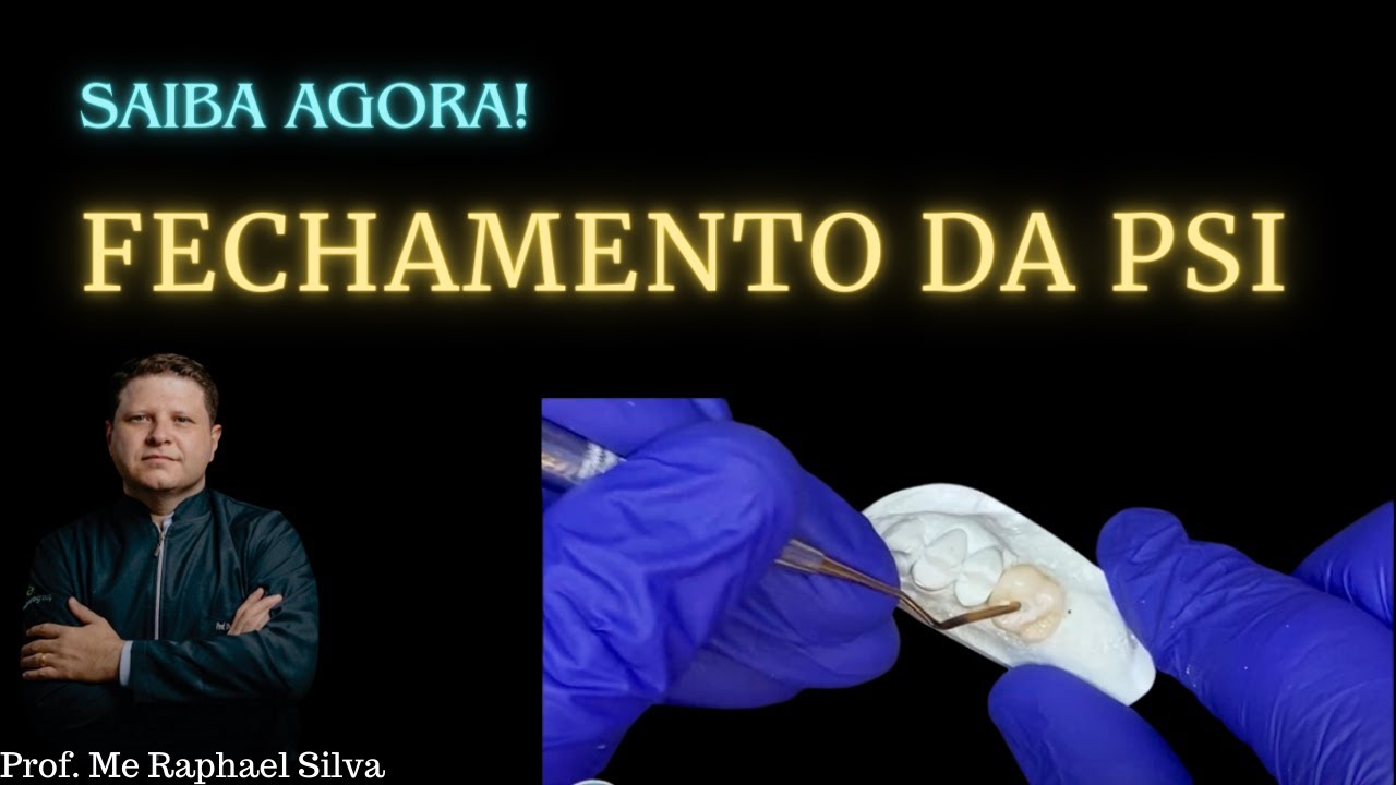FECHAMENTO DA PSI - TÉCNICA SIMPLES