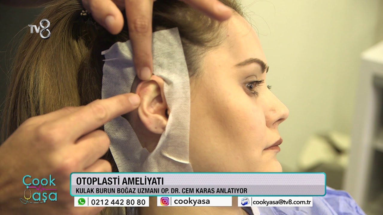 Op. Dr. Cem KARAS İle ''Otoplasti Operasyonu'' ile ilgili merak ettikleriniz...