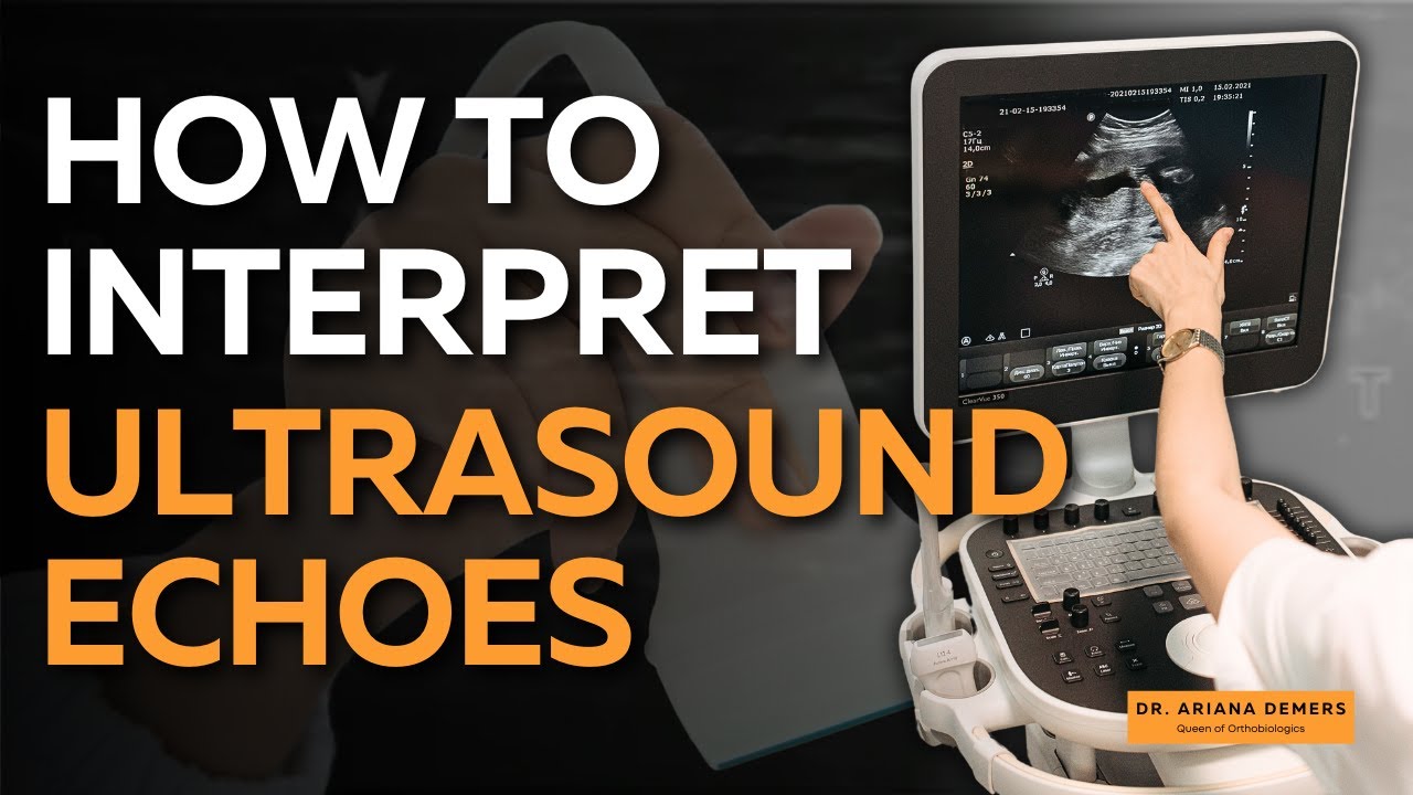 MSK Ultrasound: How To Read Ultrasound Images