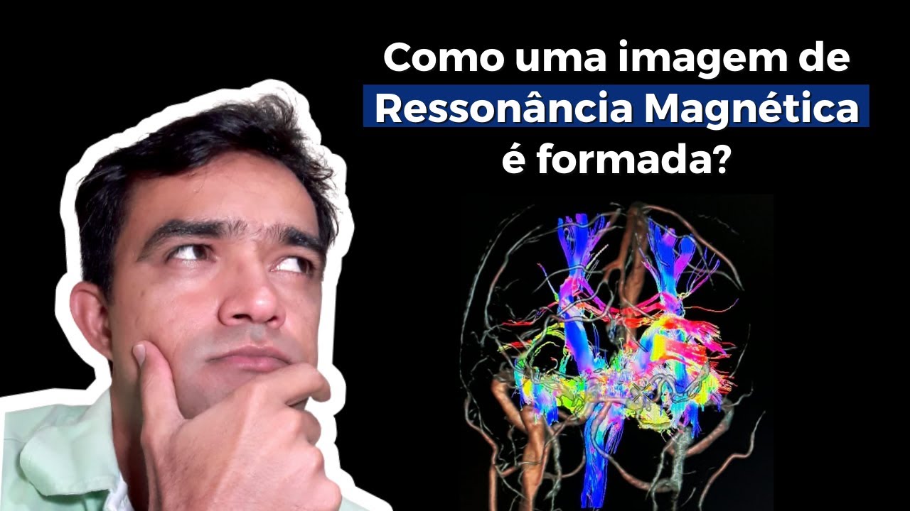 Como uma imagem de Ressonância Magnética é formada?