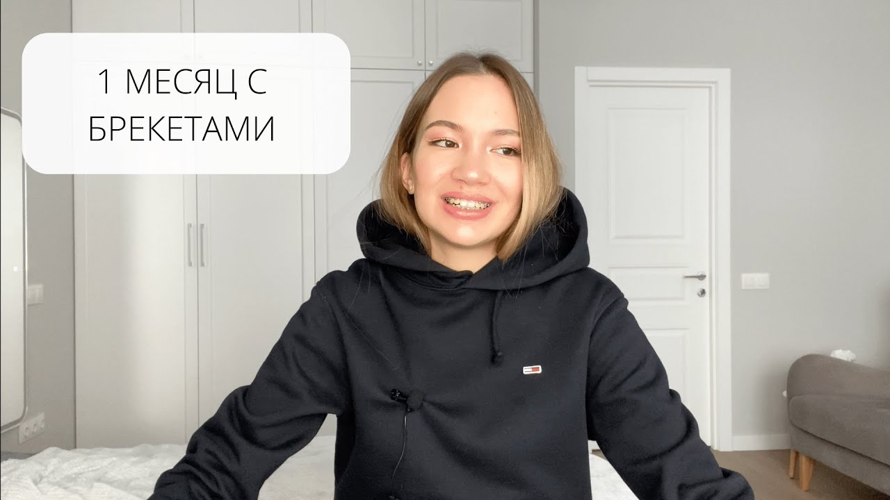 1 МЕСЯЦ С БРЕКЕТАМИ 😬: УЖЕ ВЫРАВНИВАЕТСЯ? | ПИТАНИЕ
