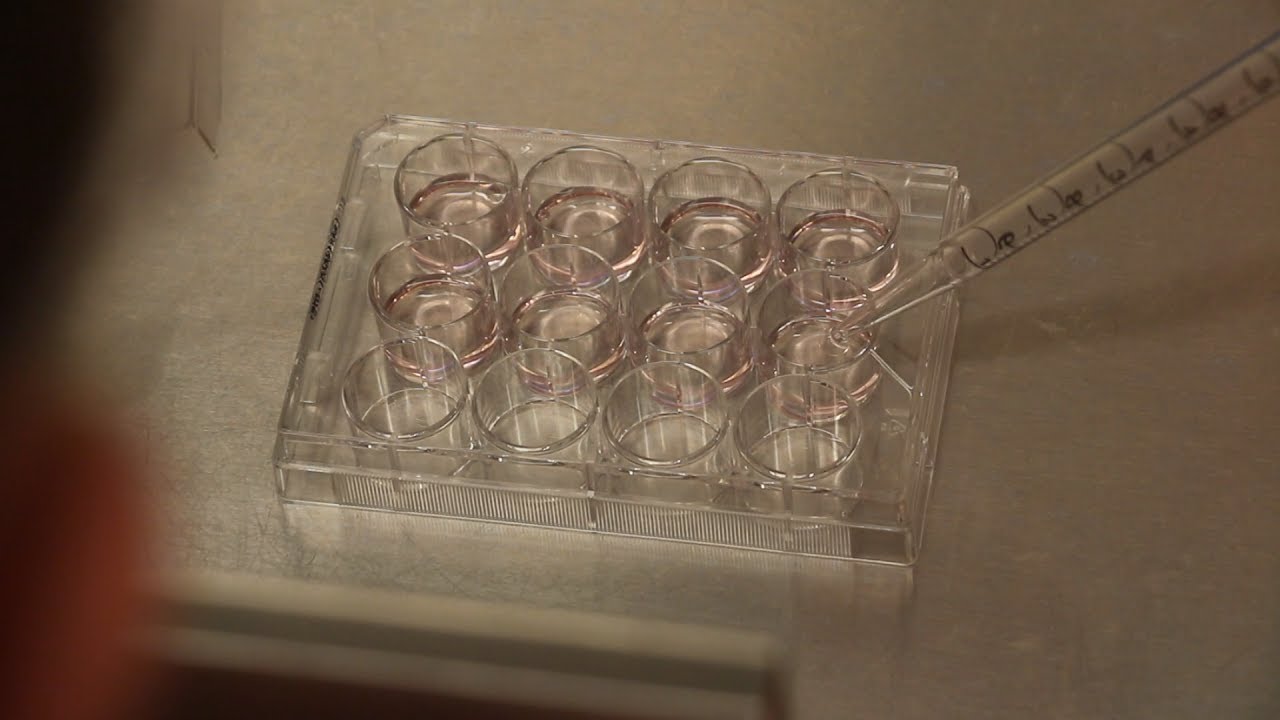 Transfection Tutorial
