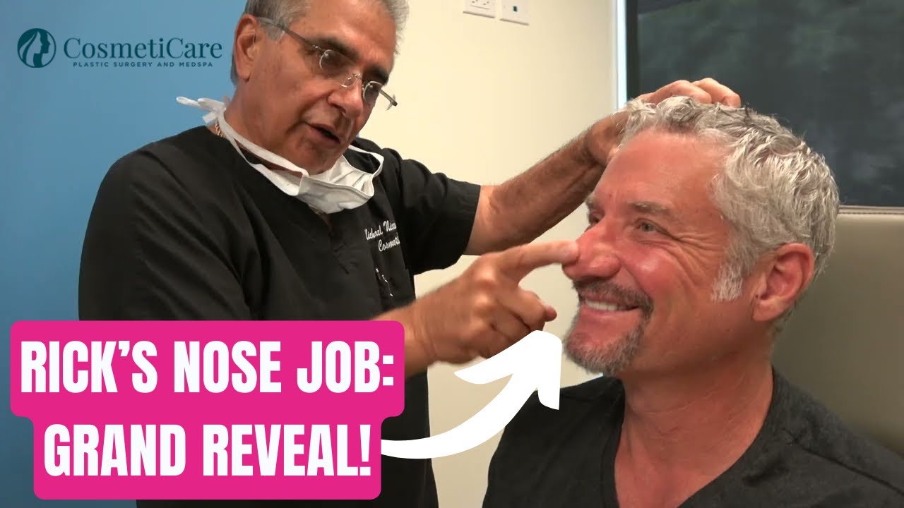 RICK&rsquo;S NOSE JOB: GRAND REVEAL!