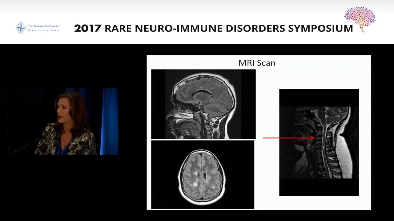 What are rare neuro-immune disorders?