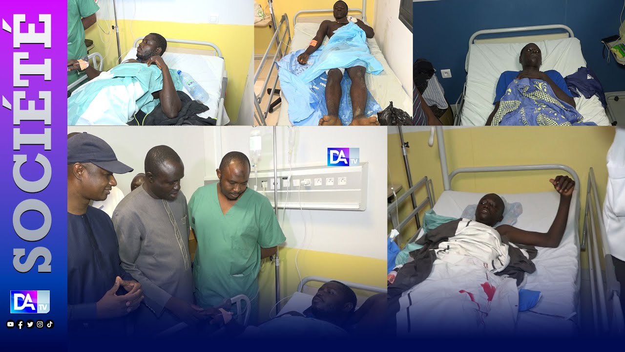 Hôpital Amath Dansokho :Le ministre de l’intérieur au chevet des blessés des manifestations à Khosan