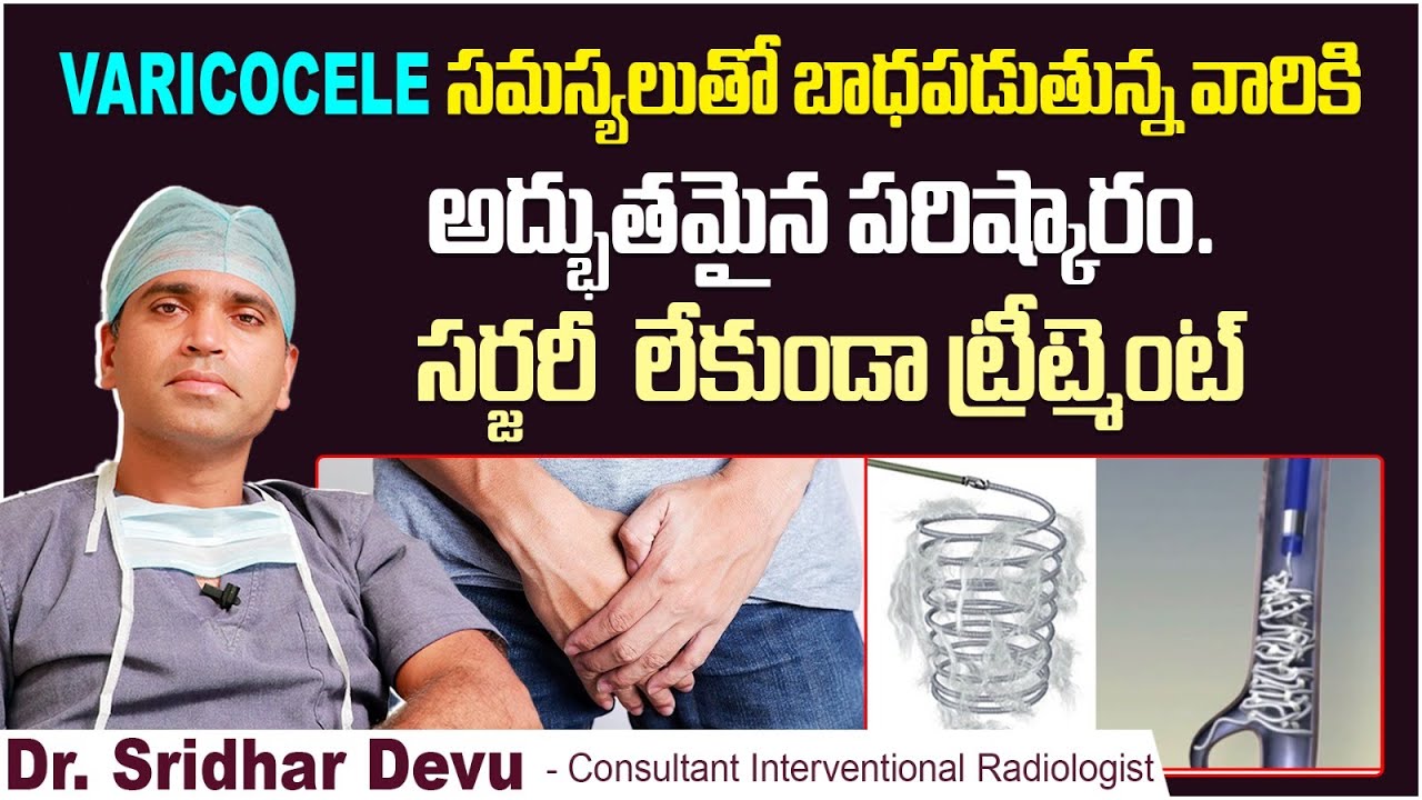 Live Varicocele Coil Embolization Procedure | Varicocele: Non Surgical Treatment In Telugu | Dr.Devu