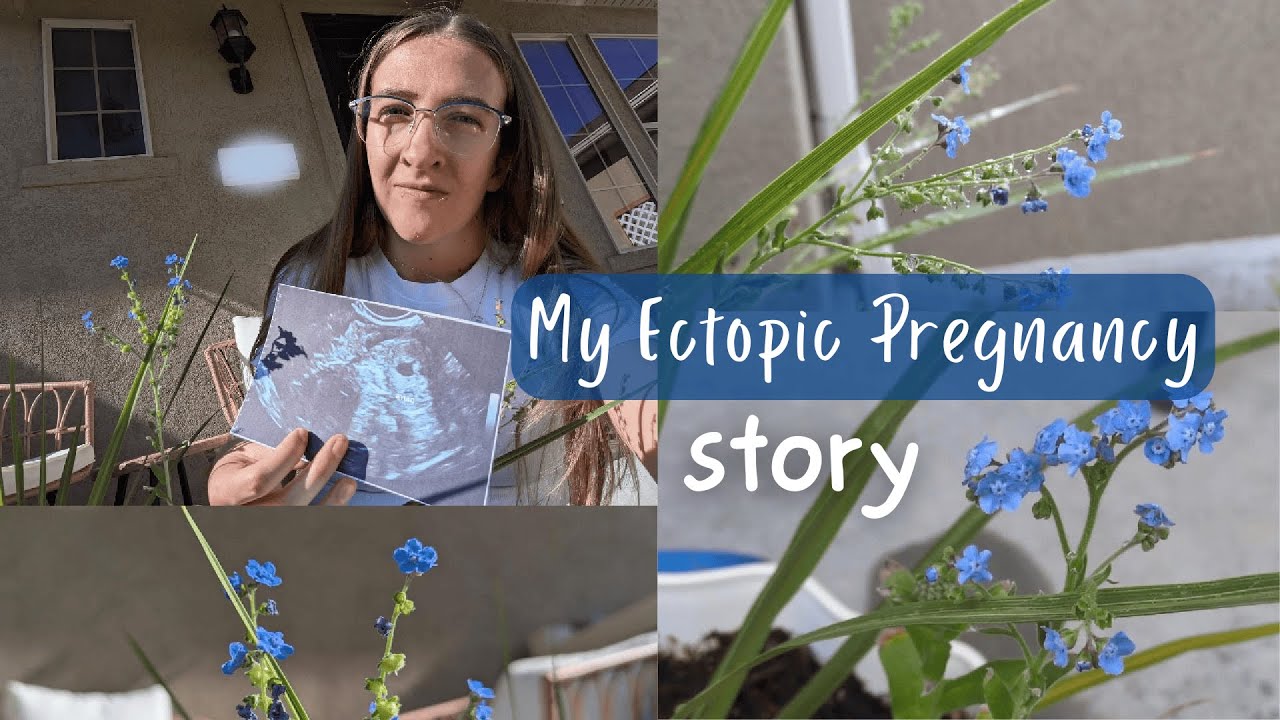 Sharing My Ectopic Pregnancy Story