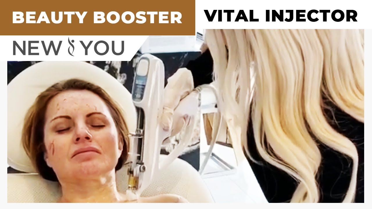 The Beauty Booster! PRP With Vital Injector | Treatments | New You Cosmetic Centres