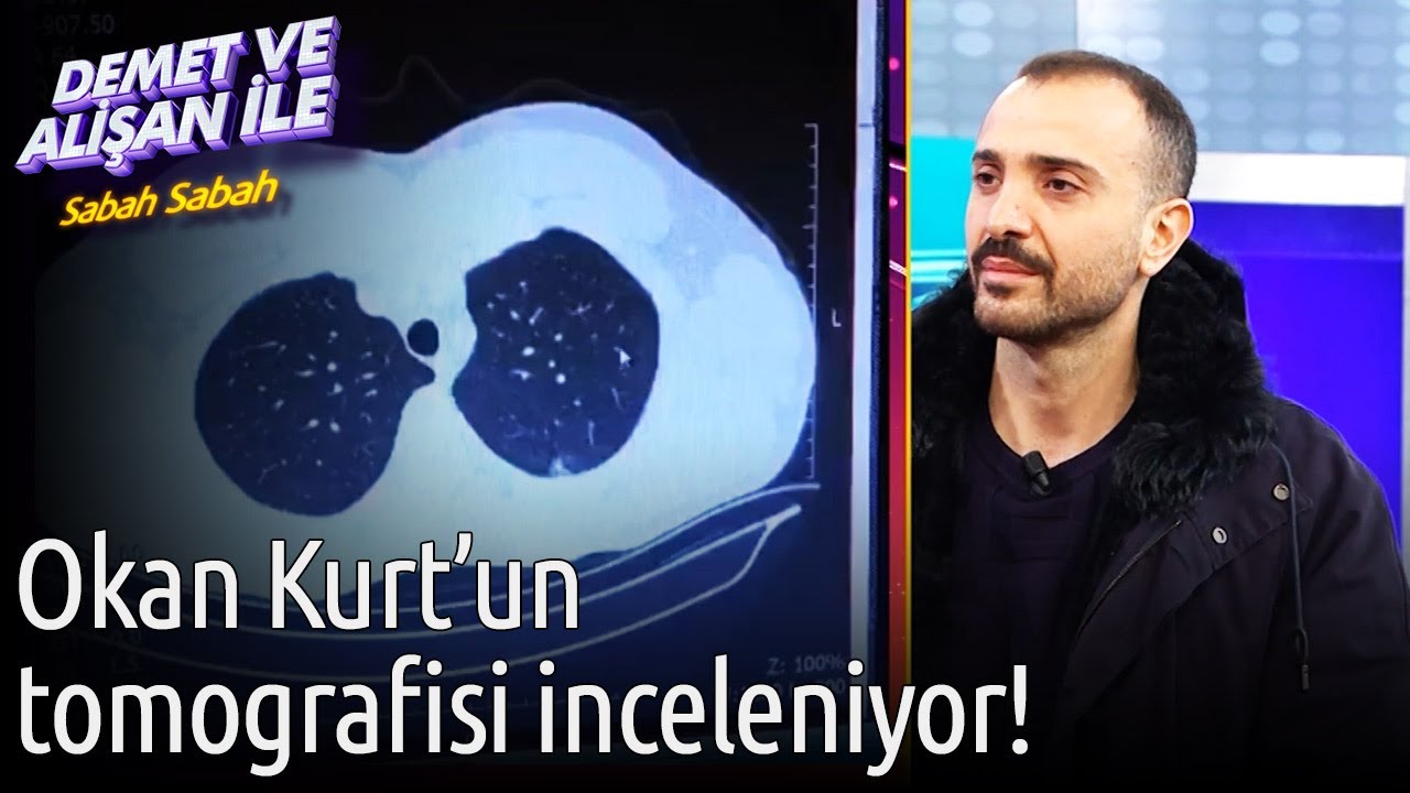 Demet ve Alişan ile Sabah Sabah |  Okan Kurt'un Tomografisi İnceleniyor!