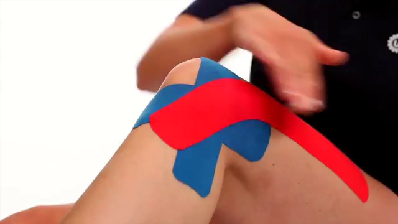 Zelf tape aanbrengen bij laterale kniepijn | UMC Utrecht